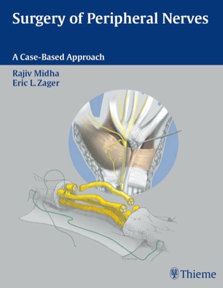 Titelbild: Surgery of Peripheral Nerves 1st edition 9780865778603