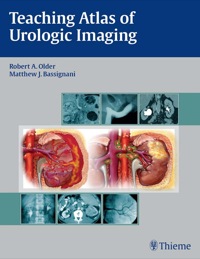 Cover image: Teaching Atlas of Urologic Imaging 1st edition 9781604060164