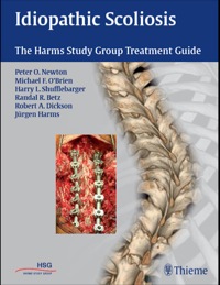Cover image: Idiopathic Scoliosis 1st edition 9781604060249