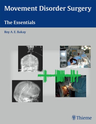 Titelbild: Movement Disorder Surgery 1st edition 9781588903976