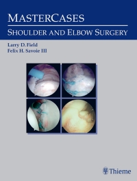 Immagine di copertina: MasterCases in Shoulder and Elbow Surgery 1st edition 9780865778733