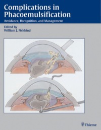 صورة الغلاف: Complications in Phacoemulsification 1st edition 9781604060676