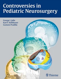 Imagen de portada: Controversies in Pediatric Neurosurgery 1st edition 9781604060744