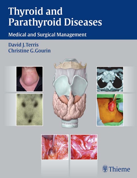 Thyroid and Parathyroid Diseases: Medical and Surgical Management, 1st Edition - FULL INSTANT DOWNLOAD | PDF DOCX EPUB