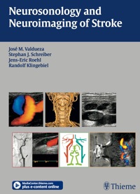Omslagafbeelding: Neurosonology and Neuroimaging of Stroke 1st edition 9781604060799