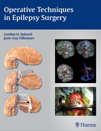 Imagen de portada: Operative Techniques in Epilepsy Surgery 1st edition 9781604060911