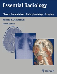 Immagine di copertina: Essential Radiology 2nd edition 9781604061192