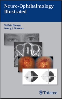 Cover image: Neuro-Ophthalmology Illustrated 1st edition 9781604061574