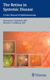 Cover image: The Retina in Systemic Disease 1st edition 9781604060553