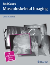 Cover image: Musculoskeletal Radiology 1st edition 9781604061802