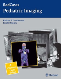 Cover image: Pediatric Imaging 1st edition 9781604061826