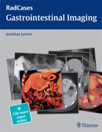 Cover image: Gastrointestinal Imaging 1st edition 9781604061840