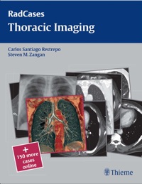 Cover image: Thoracic Imaging 1st edition 9781604061888