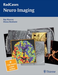 Cover image: Neuro Imaging 1st edition 9781604061901