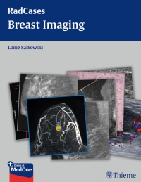 Omslagafbeelding: Radcases Breast Imaging 1st edition 9781604061918