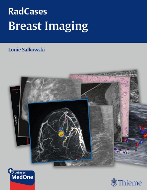 Radcases Breast Imaging, 1st  Edition - FULL INSTANT DOWNLOAD | PDF DOCX EPUB