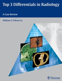 Cover image: Top 3 Differentials in Radiology 1st edition 9781604062281