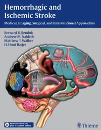 صورة الغلاف: Hemorrhagic and Ischemic Stroke 1st edition 9781604062342