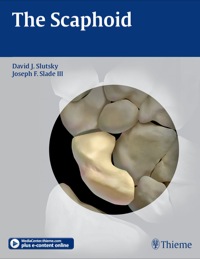 Cover image: Scaphoid 1st edition 9781604062373