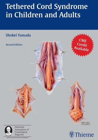表紙画像: Tethered Cord Syndrome in Children and Adults 2nd edition 9781604062410