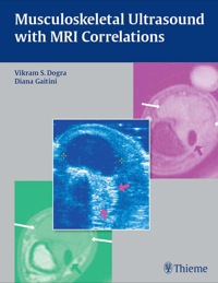 Omslagafbeelding: Musculoskeletal Ultrasound with MRI Correlations 1st edition 9781604062441