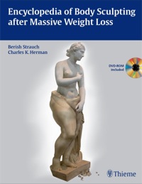 Imagen de portada: Encyclopedia of Body Sculpting after Massive Weight Loss 1st edition 9781604062465