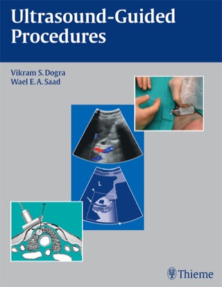 Imagen de portada: Ultrasound-Guided Procedures 1st edition 9781604061703