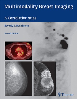 Imagen de portada: Multimodality Breast Imaging 2nd edition 9781604061710