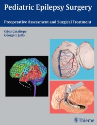 صورة الغلاف: Pediatric Epilepsy Surgery 1st edition 9781604062557