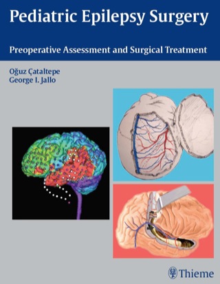 Cover image: Pediatric Epilepsy Surgery 1st edition 9781604062557