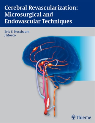 Titelbild: Cerebral Revascularization: Microsurgical and Endovascular Techniques 1st edition 9781604062632