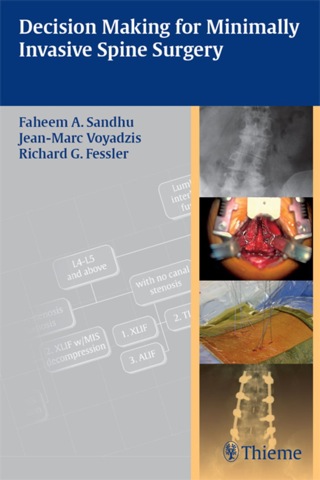 Cover image: Decision Making for Minimally Invasive Spine Surgery 1st edition 9781604062663
