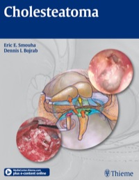 Cover image: Cholesteatoma 1st edition 9781604062779