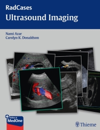 Cover image: Radcases Ultrasound Imaging 1st edition 9781604063226