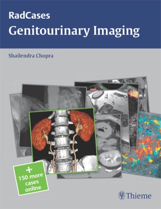 Cover image: Radcases Genitourinary Imaging 1st edition 9781604063240