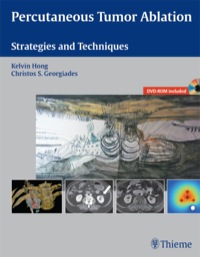 Cover image: Percutaneous Tumor Ablation 1st edition 9781604063066