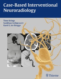 Cover image: Case-Based Interventional Neuroradiology 1st edition 9781604063738