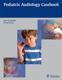 صورة الغلاف: Pediatric Audiology Casebook 1st edition 9781604063851