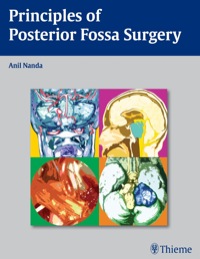 Cover image: Principles of Posterior Fossa Surgery 1st edition 9781588906632