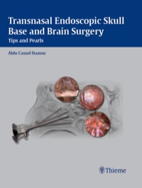 Omslagafbeelding: Transnasal Endoscopic Skull Base and Brain Surgery 1st edition 9781604063936