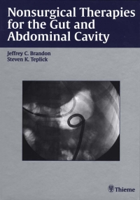 Cover image: Nonsurgical Therapies for the Gut and Abdominal Cavity 1st edition 9780865779976