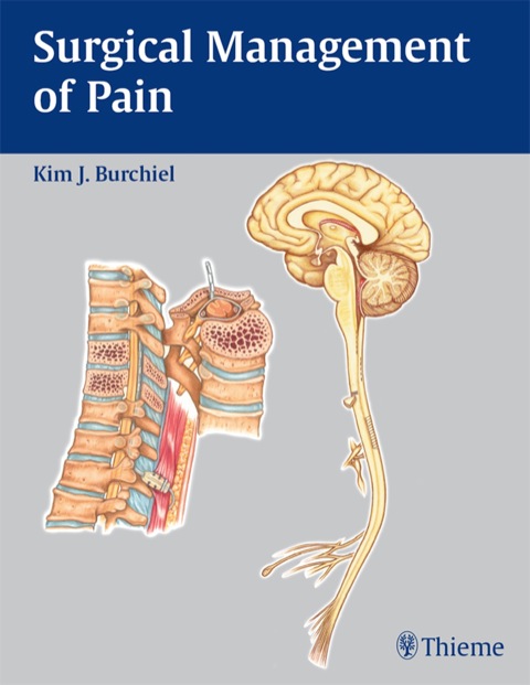 Surgical Management of Pain, 1st Edition - FULL INSTANT DOWNLOAD | PDF DOCX EPUB