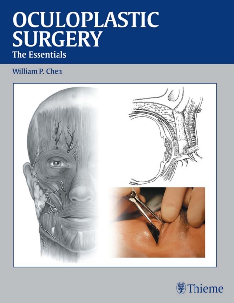 Oculoplastic Surgery: The Essentials, 1st  Edition - FULL INSTANT DOWNLOAD | PDF DOCX EPUB