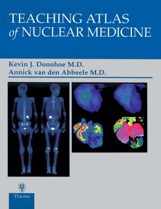 Imagen de portada: Teaching Atlas of Nuclear Medicine 1st edition 9780865777750