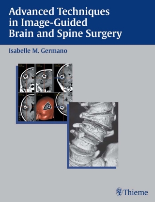 Cover image: Advanced Techniques in Image-Guided Brain and Spine Surgery 1st edition 9781588900678