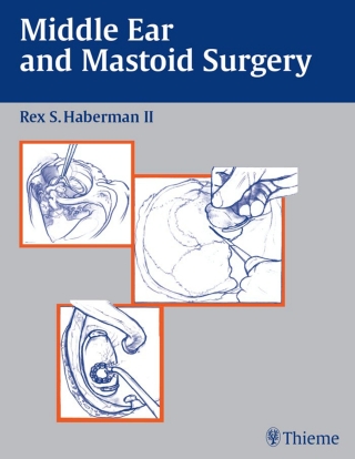 表紙画像: Middle Ear and Mastoid Surgery 1st edition 9781588901736