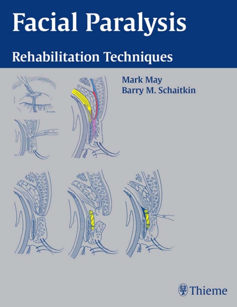 Facial Paralysis: Rehabilitation Techniques, 1st  Edition - FULL INSTANT DOWNLOAD | PDF DOCX EPUB