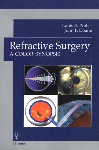 Cover image: Refractive Surgery 1st edition 9780865779143