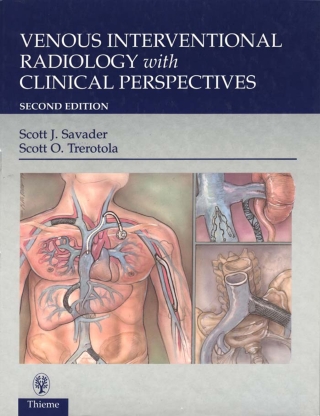 Cover image: Venous Interventional Radiology With Clinical Perspectives 2nd edition 9780865778948