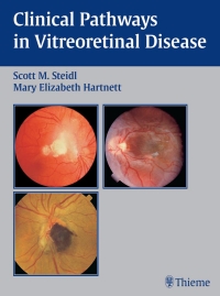 Cover image: Clinical Pathways In Vitreoretinal Disease 1st edition 9781588901194